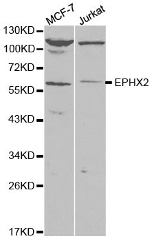 Western blot (WB) analysis of EPHX2 polyclonal antibody