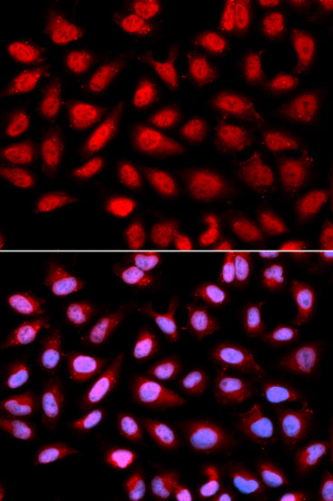 Immunofluorescence analysis of U2OS cells using Ser/thr-PP2A activator  antibody . Blue: DAPI for nuclear staining.