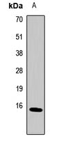 Western blot analysis of extracts of various cell lines, using MT2A Rabbit pAb  at 1:1000 dilution.
Secondary antibody: HRP Goat Anti-Rabbit IgG   at 1:10000 dilution.
Lysates/proteins: 25ug per lane.
Blocking buffer: 3% nonfat dry milk in TBST.
Detection: ECL Basic Kit .
Exposure time: 30s.