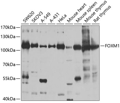 Western blot analysis of extracts of various cell lines, using FOXM1 antibody  at 1:1000 dilution.
Secondary antibody: HRP Goat Anti-Rabbit IgG   at 1:10000 dilution.
Lysates/proteins: 25ug per lane.
Blocking buffer: 3% nonfat dry milk in TBST.
Detection: ECL Basic Kit .
Exposure time: 90s.