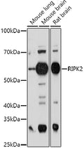 Western blot analysis of extracts of various cell lines, using RIPK2  antibody  at 1:1000 dilution.
Secondary antibody: HRP Goat Anti-Rabbit IgG   at 1:10000 dilution.
Lysates/proteins: 25ug per lane.
Blocking buffer: 3% nonfat dry milk in TBST.
Detection: ECL Basic Kit .
Exposure time: 90s.