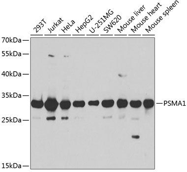 Western blot analysis of extracts of various cell lines, using PSMA1 antibody  at 1:1000 dilution.
Secondary antibody: HRP Goat Anti-Rabbit IgG   at 1:10000 dilution.
Lysates/proteins: 25ug per lane.
Blocking buffer: 3% nonfat dry milk in TBST.