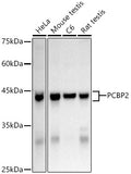 Western blot analysis of extracts of various cell lines, using hnRNP E2/PCBP2 Rabbit pAb antibody  at 1:1000 dilution.
Secondary antibody: HRP Goat Anti-Rabbit IgG   at 1:10000 dilution.
Lysates/proteins: 25ug per lane.
Blocking buffer: 3% nonfat dry milk in TBST.
Detection: ECL Basic Kit .
Exposure time: 10s.