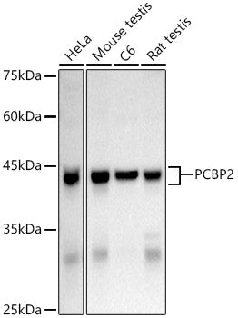 Western blot analysis of extracts of various cell lines, using hnRNP E2/PCBP2 Rabbit pAb antibody  at 1:1000 dilution.
Secondary antibody: HRP Goat Anti-Rabbit IgG   at 1:10000 dilution.
Lysates/proteins: 25ug per lane.
Blocking buffer: 3% nonfat dry milk in TBST.
Detection: ECL Basic Kit .
Exposure time: 10s.