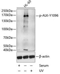 Phospho-ALK-Y1096 polyclonal antibody – Figure 1 of 1