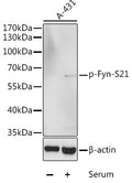 Phospho-Fyn-S21 polyclonal antibody – Figure 1 of 1