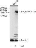 Phospho-PDGFR alpha-Y754 polyclonal antibody – Figure 1 of 1
