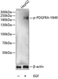 Phospho-PDGFR alpha-Y849 polyclonal antibody – Figure 1 of 1