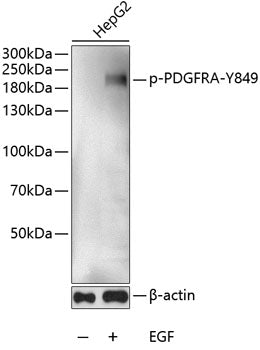 Phospho-PDGFR alpha-Y849 polyclonal antibody – Figure 1 of 1