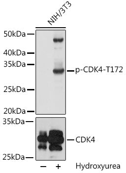 Phospho-CDK4-T172 polyclonal antibody – Figure 1 of 1