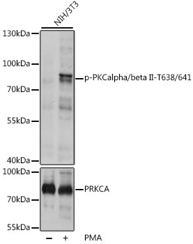Phospho-PKCalpha/beta II-T638/641 polyclonal antibody – Figure 1 of 3