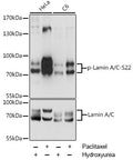 Phospho-Lamin A/C-S22 polyclonal antibody – Figure 1 of 2