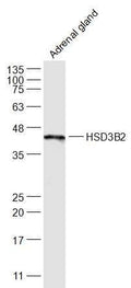 Western blot (WB) analysis of HSD3B polyclonal antibody at 1:1000 dilution