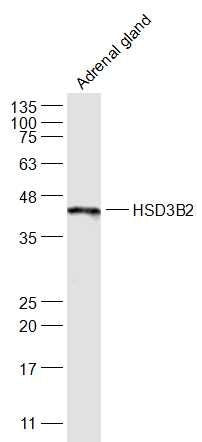 Western blot (WB) analysis of HSD3B polyclonal antibody at 1:1000 dilution