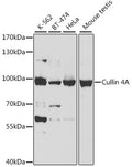 Western blot analysis of extracts of various cell lines, using Cullin 4A antibody  at 1:500 dilution.
Secondary antibody: HRP Goat Anti-Rabbit IgG   at 1:10000 dilution.
Lysates/proteins: 25ug per lane.
Blocking buffer: 3% nonfat dry milk in TBST.
Detection: ECL Basic Kit .
Exposure time: 5s.