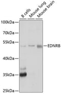 Western blot analysis of extracts of various cell lines, using EDNRB antibody  at 1:1000 dilution.
Secondary antibody: HRP…
