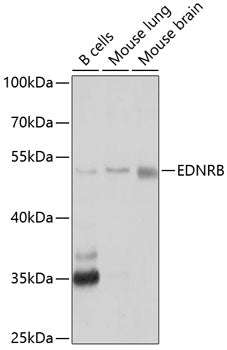 Western blot analysis of extracts of various cell lines, using EDNRB antibody  at 1:1000 dilution.
Secondary antibody: HRP…