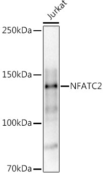Western blot analysis of extracts of Jurkat cells, using   at 1:1000 dilution.
Secondary antibody: HRP Goat Anti-Rabbit IgG   at 1:10000 dilution.
Lysates/proteins: 25ug per lane.
Blocking buffer: 3% nonfat dry milk in TBST.
Detection: ECL Basic Kit .
Exposure time: 30s.
