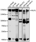 Western blot analysis of extracts of various cell lines, using PELP1 antibody  at 1:1000 dilution.
Secondary antibody: HRP…