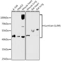 Western blot analysis of extracts of various cell lines, using Lumican   antibody  at 1:1000 dilution.
Secondary antibody: HRP Goat Anti-Rabbit IgG   at 1:10000 dilution.
Lysates/proteins: 25ug per lane.
Blocking buffer: 3% nonfat dry milk in TBST.
Detection: ECL Basic Kit .
Exposure time: 180s.
