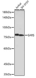 Western blot analysis of extracts of various cell lines, using GARS antibody  at 1:1000 dilution.
Secondary antibody: HRP Goat Anti-Rabbit IgG   at 1:10000 dilution.
Lysates/proteins: 25ug per lane.
Blocking buffer: 3% nonfat dry milk in TBST.
Detection: ECL Basic Kit .
Exposure time: 60s.