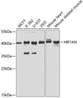 Western blot analysis of extracts of various cell lines, using HIF1AN/FIH1 antibody  at 1:1000 dilution.
Secondary antibody: HRP Goat Anti-Rabbit IgG   at 1:10000 dilution.
Lysates/proteins: 25ug per lane.
Blocking buffer: 3% nonfat dry milk in TBST.
Detection: ECL Basic Kit .
Exposure time: 30s.