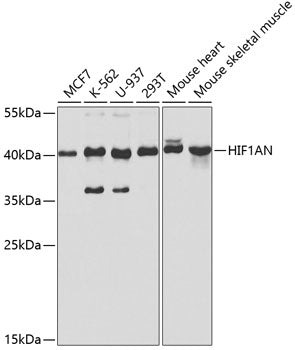 Western blot analysis of extracts of various cell lines, using HIF1AN/FIH1 antibody  at 1:1000 dilution.
Secondary antibody: HRP Goat Anti-Rabbit IgG   at 1:10000 dilution.
Lysates/proteins: 25ug per lane.
Blocking buffer: 3% nonfat dry milk in TBST.
Detection: ECL Basic Kit .
Exposure time: 30s.