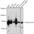 Western blot analysis of extracts of various cell lines, using L-Plastin/LCP1 antibody  at 1:1000 dilution.
Secondary antibody: HRP Goat Anti-Rabbit IgG   at 1:10000 dilution.
Lysates/proteins: 25ug per lane.
Blocking buffer: 3% nonfat dry milk in TBST.
Detection: ECL Basic Kit .
Exposure time: 5s.