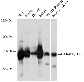 Western blot analysis of extracts of various cell lines, using L-Plastin/LCP1 antibody  at 1:1000 dilution.
Secondary antibody: HRP Goat Anti-Rabbit IgG   at 1:10000 dilution.
Lysates/proteins: 25ug per lane.
Blocking buffer: 3% nonfat dry milk in TBST.
Detection: ECL Basic Kit .
Exposure time: 5s.