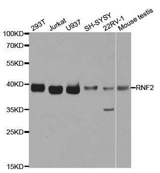 Western blot analysis of Jurkat, using RING1B/RNF2 antibody  at  1:490 dilution.
Secondary antibody: HRP Goat Anti-Rabbit IgG   at 1:10000 dilution.
Lysates/proteins: 25ug per lane.
Blocking buffer: 3% nonfat dry milk in TBST.
Detection: ECL Basic Kit .
Exposure time: 1s.