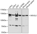 Western blot analysis of extracts of various cell lines, using SKIV2L2 antibody  at 1:1000 dilution.
Secondary antibody: HRP Goat Anti-Rabbit IgG   at 1:10000 dilution.
Lysates/proteins: 25ug per lane.
Blocking buffer: 3% nonfat dry milk in TBST.
Detection: ECL Basic Kit .
Exposure time: 60s.