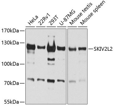 Western blot analysis of extracts of various cell lines, using SKIV2L2 antibody  at 1:1000 dilution.
Secondary antibody: HRP Goat Anti-Rabbit IgG   at 1:10000 dilution.
Lysates/proteins: 25ug per lane.
Blocking buffer: 3% nonfat dry milk in TBST.
Detection: ECL Basic Kit .
Exposure time: 60s.