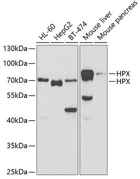 Western blot analysis of HPX polyclonal antibody