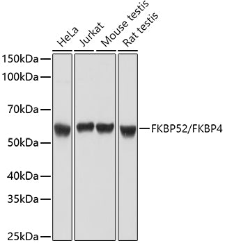 Western blot analysis of extracts of various cell lines, using FKBP52/FKBP4  antibody  at 1:1000 dilution.
Secondary antibody: HRP Goat Anti-Rabbit IgG   at 1:10000 dilution.
Lysates/proteins: 25ug per lane.
Blocking buffer: 3% nonfat dry milk in TBST.
Detection: ECL Basic Kit .
Exposure time: 5s.