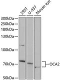 Western blot analysis of extracts of various cell lines, using OCA2 antibody  at 1:1000 dilution.
Secondary antibody: HRP Goat Anti-Rabbit IgG   at 1:10000 dilution.
Lysates/proteins: 25ug per lane.
Blocking buffer: 3% nonfat dry milk in TBST.