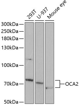 Western blot analysis of extracts of various cell lines, using OCA2 antibody  at 1:1000 dilution.
Secondary antibody: HRP Goat Anti-Rabbit IgG   at 1:10000 dilution.
Lysates/proteins: 25ug per lane.
Blocking buffer: 3% nonfat dry milk in TBST.