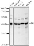 Western blot analysis of various lysates, using FH antibody  at 1:500 dilution.
Secondary antibody: HRP Goat Anti-Rabbit…