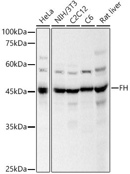 Western blot analysis of various lysates, using FH antibody  at 1:500 dilution.
Secondary antibody: HRP Goat Anti-Rabbit…