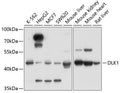 Western blot analysis of extracts of various cell lines, using DLK1 antibody  at 1:1000 dilution.
Secondary antibody: HRP…