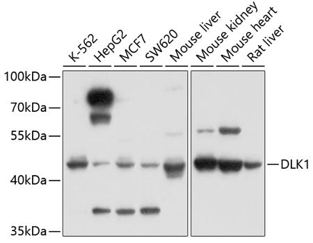Western blot analysis of extracts of various cell lines, using DLK1 antibody  at 1:1000 dilution.
Secondary antibody: HRP…