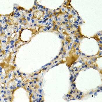Immunohistochemistry of paraffin-embedded rat lung using IL9 antibody  at dilution of 1:200 .Perform microwave antigen retrieval with 10 mM PBS buffer pH 7.2 before commencing with IHC staining protocol.