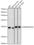 Western blot analysis of extracts of various cell lines, using HSPB8/HSP22 antibody  at 1:3000 dilution.
Secondary antibody: HRP Goat Anti-Rabbit IgG   at 1:10000 dilution.
Lysates/proteins: 25ug per lane.
Blocking buffer: 3% nonfat dry milk in TBST.
Detection: ECL Basic Kit .
Exposure time: 1s.