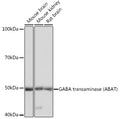 Western blot analysis of extracts of various cell lines, using GABA transaminase ) Polyclonal Antibody  at 1:1000 dilution.
Secondary antibody: HRP Goat Anti-Rabbit IgG   at 1:10000 dilution.
Lysates/proteins: 25ug per lane.
Blocking buffer: 3% nonfat dry milk in TBST.
Detection: ECL Basic Kit .
Exposure time: 3s.