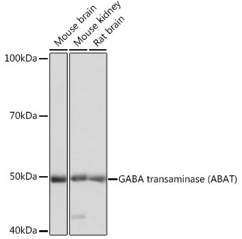 Western blot analysis of extracts of various cell lines, using GABA transaminase ) Polyclonal Antibody  at 1:1000 dilution.
Secondary antibody: HRP Goat Anti-Rabbit IgG   at 1:10000 dilution.
Lysates/proteins: 25ug per lane.
Blocking buffer: 3% nonfat dry milk in TBST.
Detection: ECL Basic Kit .
Exposure time: 3s.