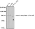Western blot analysis of extracts of various cell lines, using PP2A-B56γ/PR61γ/PP2A-B56γ/PR61γ/PPP2R5C antibody  at 1:1000 dilution.
Secondary antibody: HRP Goat Anti-Rabbit IgG   at 1:10000 dilution.
Lysates/proteins: 25ug per lane.
Blocking buffer: 3% nonfat dry milk in TBST.
Detection: ECL Basic Kit .
Exposure time: 30s.