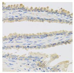 Immunohistochemistry analysis of paraffinembedded Human prostate using INSL3 pAb at dilution of 1:100 (40xlens).