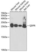 Western blot analysis of extracts of various cell lines, using QDPR antibody  at 1:1000 dilution.
Secondary antibody: HRP Goat Anti-Rabbit IgG   at 1:10000 dilution.
Lysates/proteins: 25ug per lane.
Blocking buffer: 3% nonfat dry milk in TBST.
Detection: ECL Basic Kit .
Exposure time: 90s.
