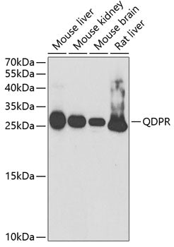 Western blot analysis of extracts of various cell lines, using QDPR antibody  at 1:1000 dilution.
Secondary antibody: HRP Goat Anti-Rabbit IgG   at 1:10000 dilution.
Lysates/proteins: 25ug per lane.
Blocking buffer: 3% nonfat dry milk in TBST.
Detection: ECL Basic Kit .
Exposure time: 90s.