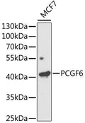 Western blot analysis of extracts of MCF7 cells, using PCGF6 antibody  at 1:1000 dilution.
Secondary antibody: HRP Goat Anti-Rabbit IgG   at 1:10000 dilution.
Lysates/proteins: 25ug per lane.
Blocking buffer: 3% nonfat dry milk in TBST.
Detection: ECL Enhanced Kit .
Exposure time: 120s.