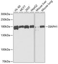 WesternBlot (WB) analysis of DIAPH1 polyclonal antibody